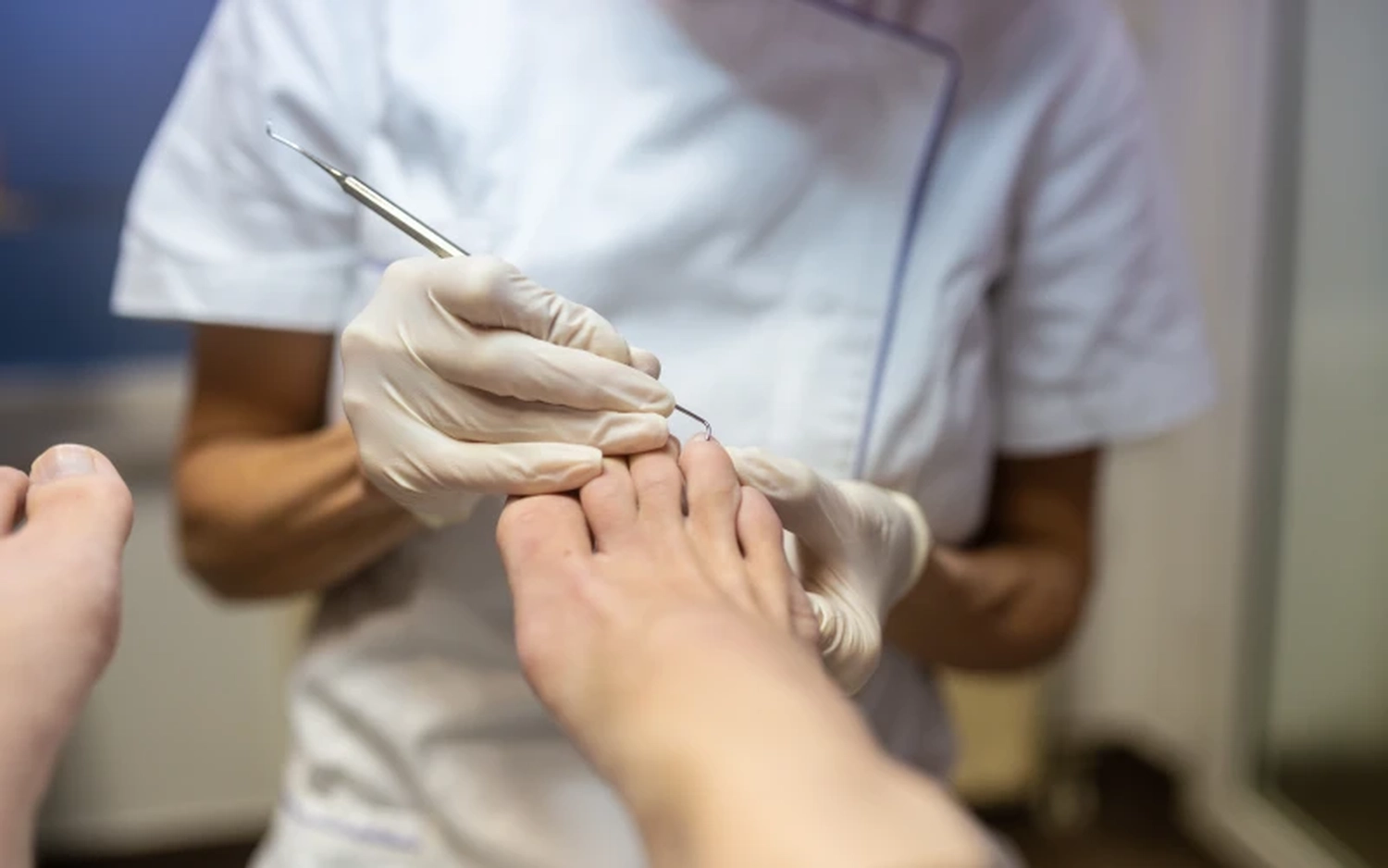 Praxis für Podologie Ramona Herczeg - Medizinische Fußbehandlung - Behandlung von Nagelmykose (Nagelpilz)