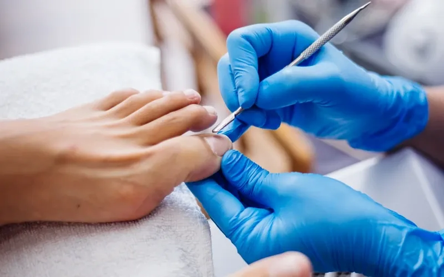 Praxis für Podologie Ramona Herczeg - Medizinische Fußbehandlung -Anwendung von Nagelspangen