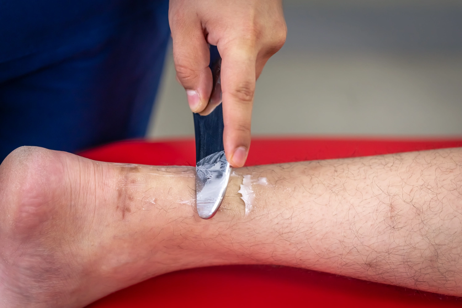 Praxis für Podologie Ramona Herczeg - Medizinische Fußbehandlung - Hyperkeratose